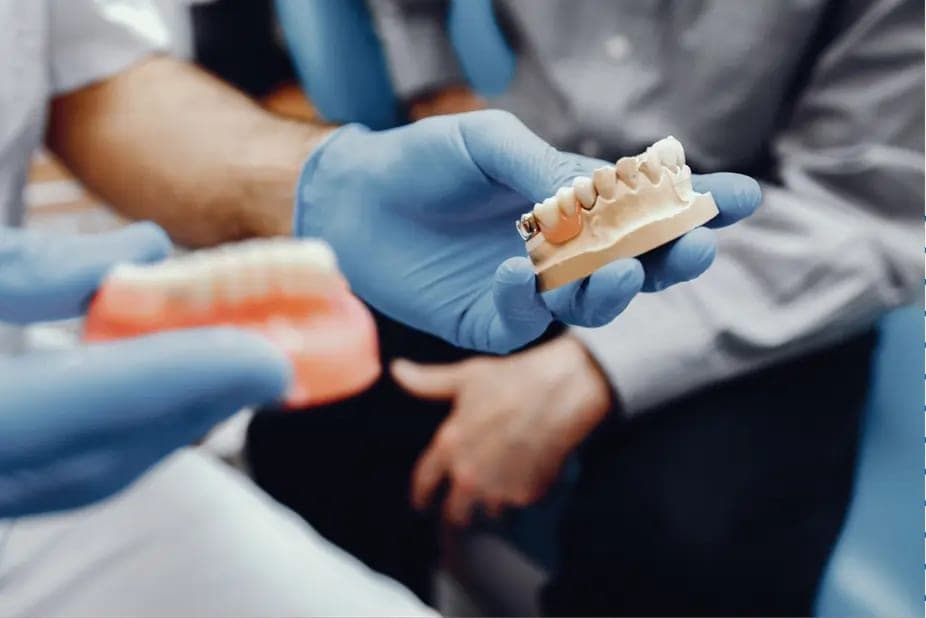 Gloved hands holding jaw models with a fixed bridge in place