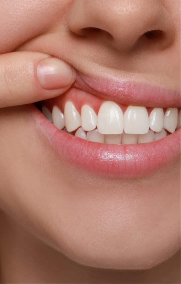 A lifted lip showing firm, healthy gums