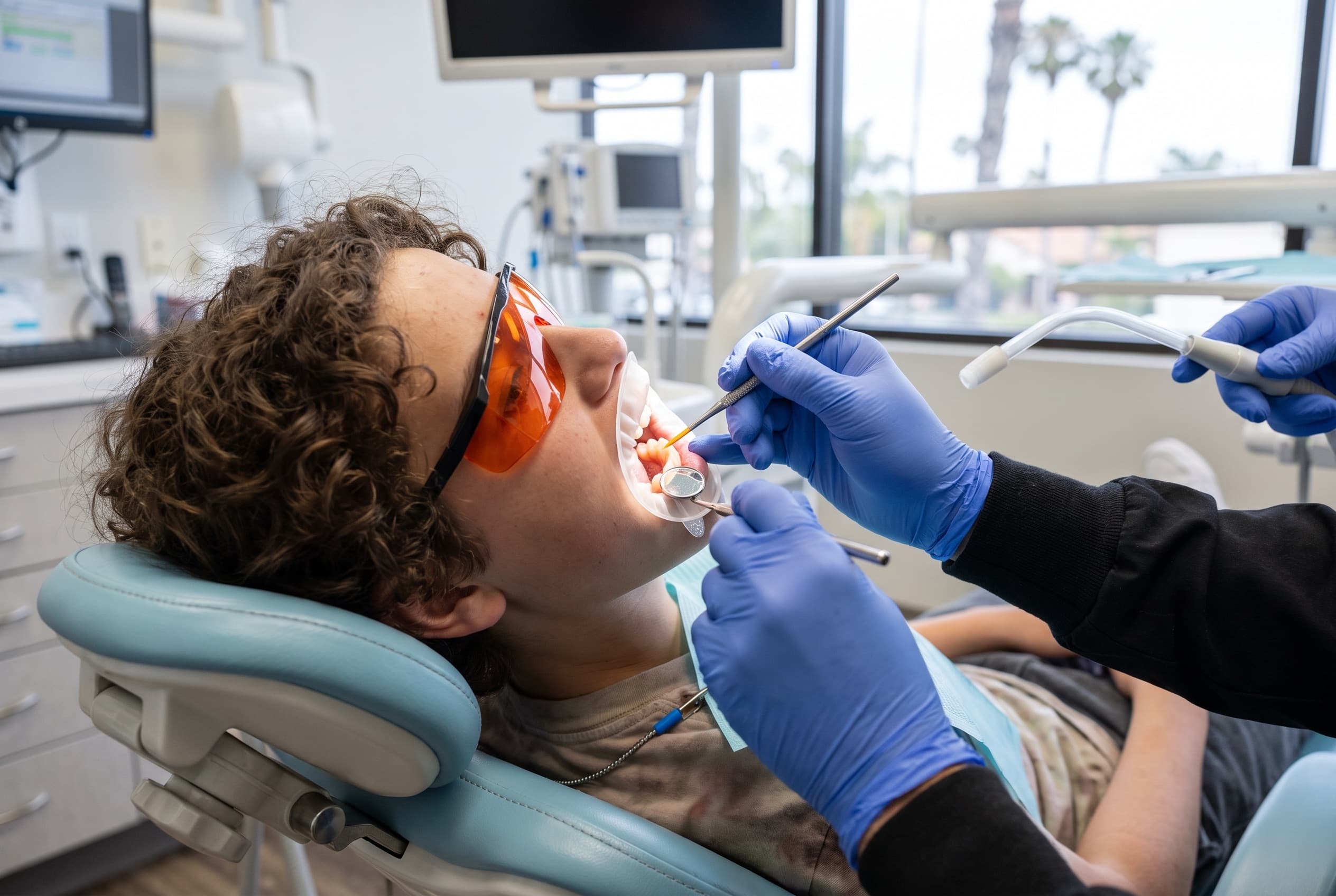 Sealant being painted into the grooves of a teenager's back molar, the tooth isolated and dry
