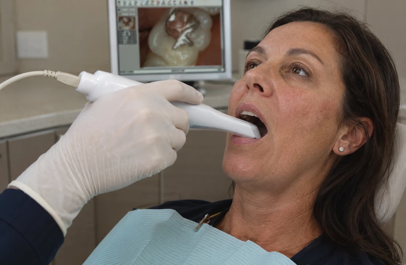 An intraoral camera in a patient's mouth, the tooth it is showing enlarged on the monitor behind