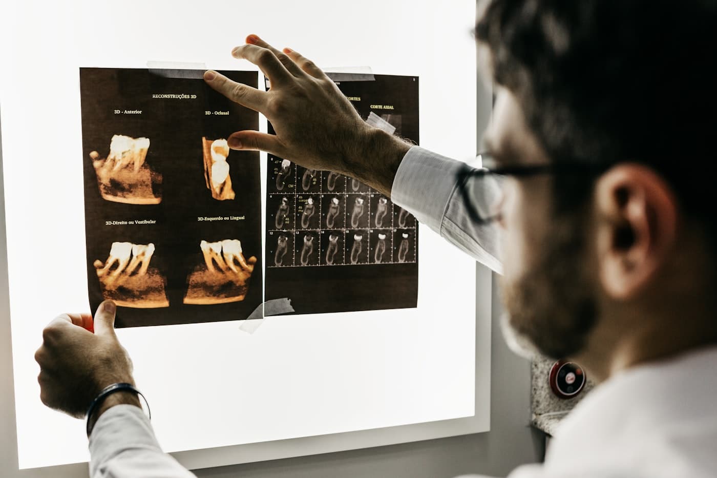 A dentist pointing out detail on a panel of dental X-rays