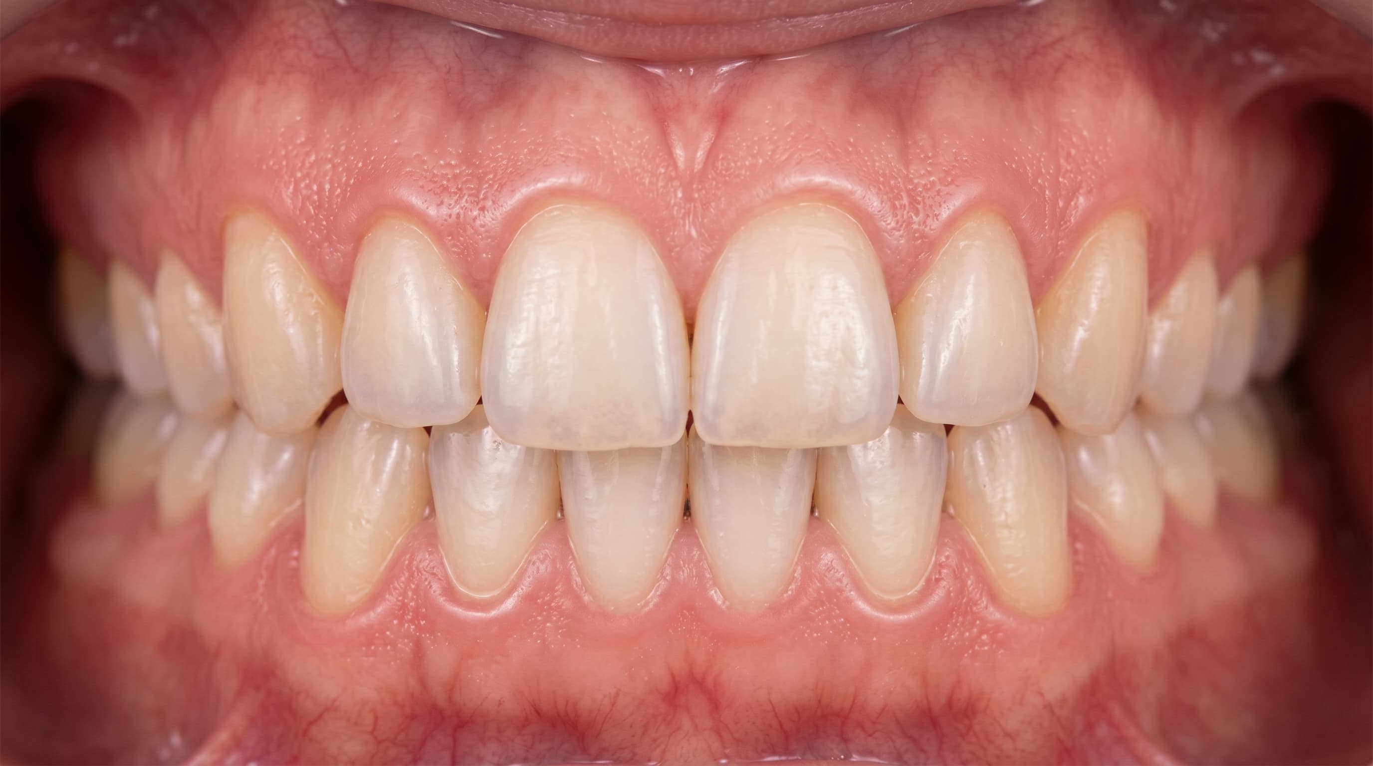 Dentist Performing Gum Surgery with Microsurgical Instruments