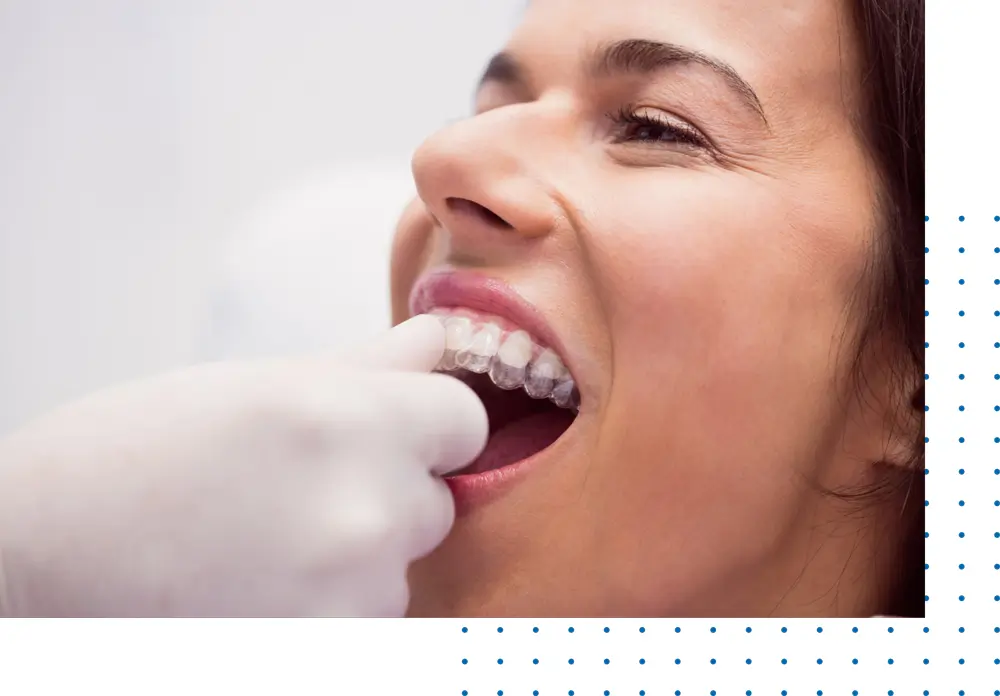 Best Soft Denture Liners In Los Angeles