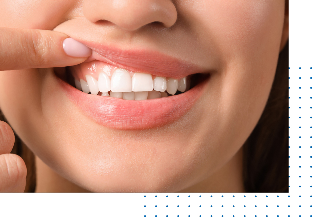 Oral Hygiene Services In Los Angeles