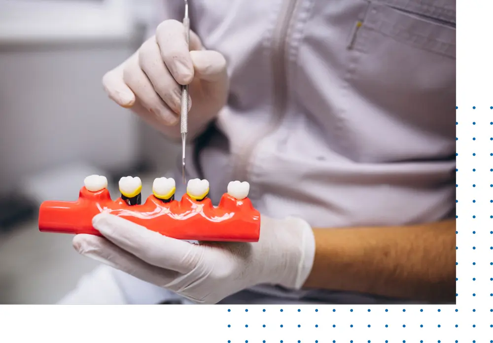 Socket Preservation Dentist In Los Angeles